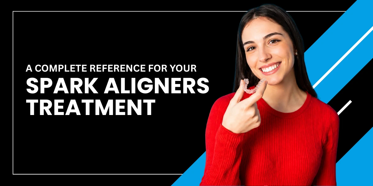 A Complete Reference for Your Spark Aligners Treatment